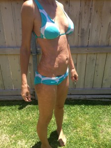 Star_Torso_Before_From_Right_Side